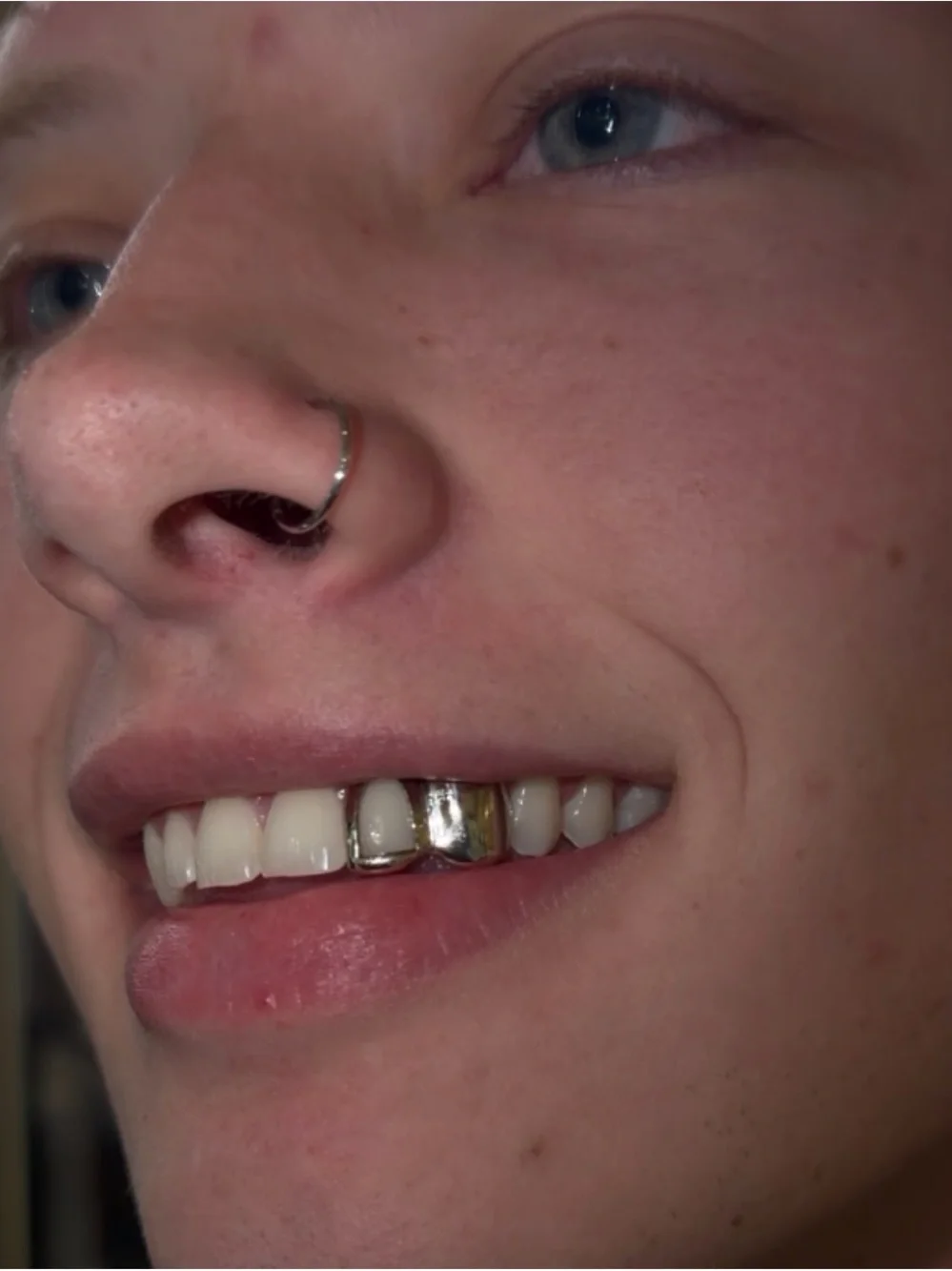 Custom Grillz Mold Kit – Start Your Custom Grillz Order – $150 Deposit